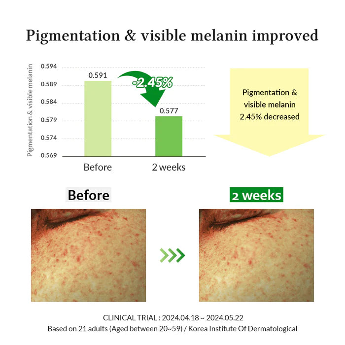Gentle Vitamin C Serum | Suero facial