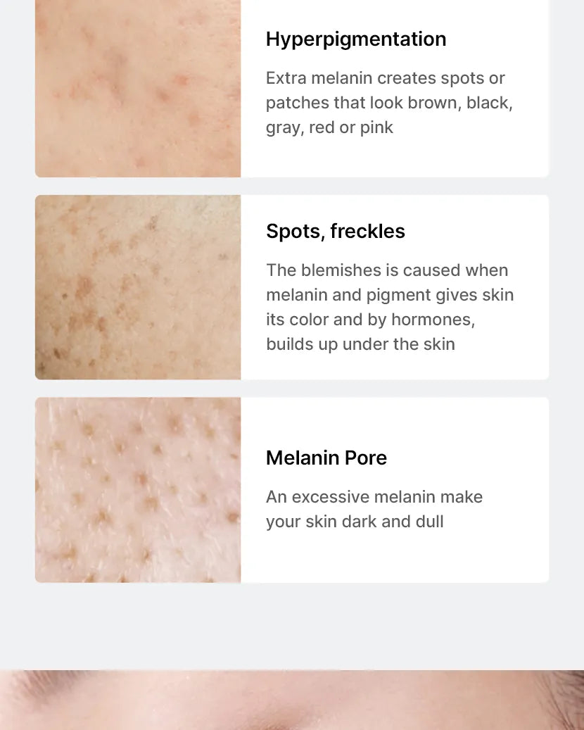 Pore + Dark Spot Brightening Serum | Suero Facial