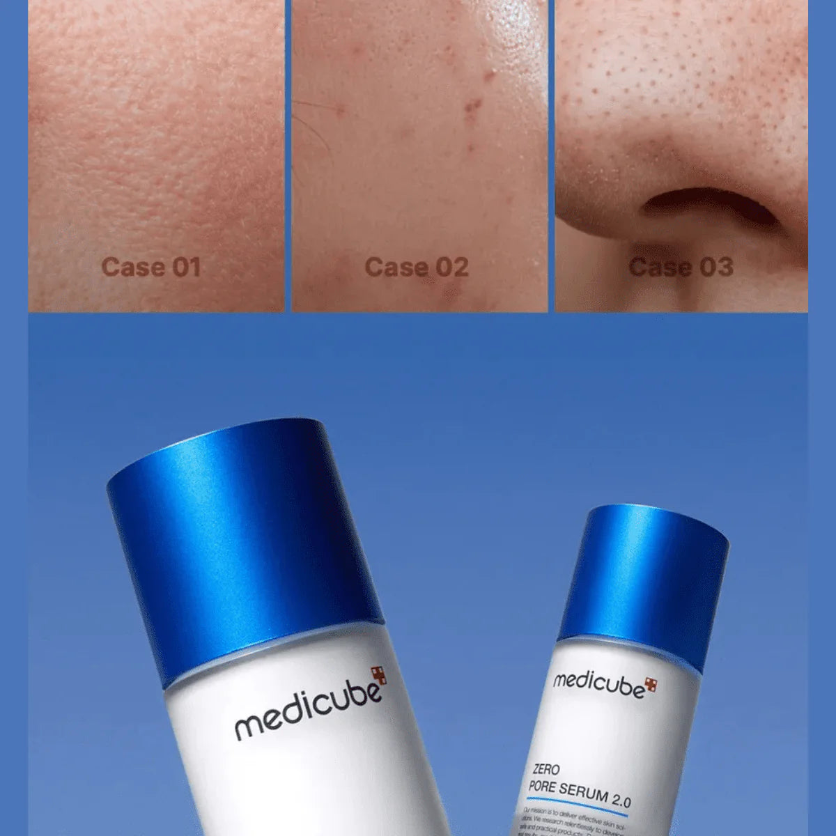 ZERO PORE SERUM 2.0 | Suero para poros