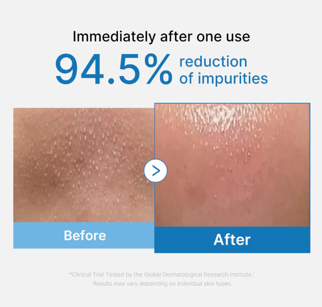 Zero Pore Blackhead Deep Cleansing Oil | Aceite limpiador profundo para puntos negros Zero Pore