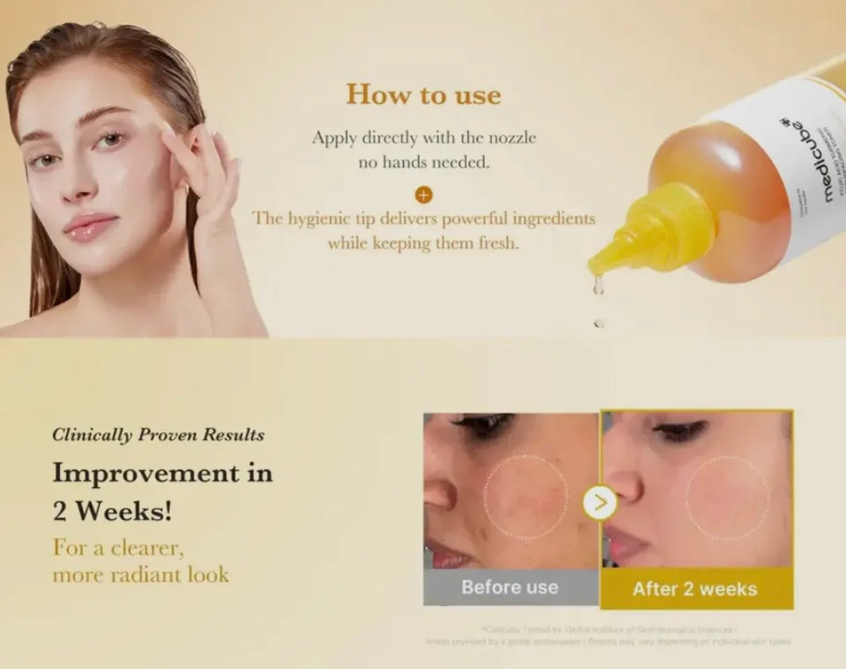 Kojic Acid Turmetic Resurfacing Toner | Tónico facial ácido Kojico | Despigmentante y luminosidad