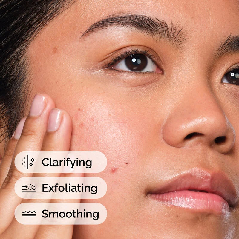 Salicylic Acid 2% Solution | Suero para rostro | Ácido salicilico