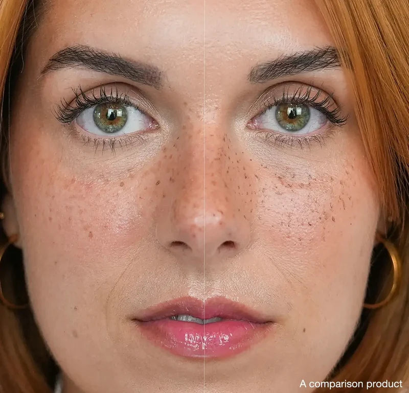 Berry Freckled Pen | Plumín para pecas