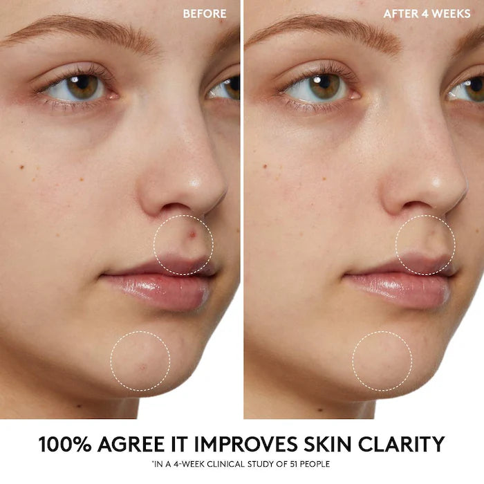 Cherry Dub Pore Purify’r Gel Cleanser | Limpiador facial