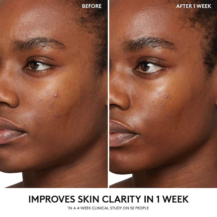 Cherry Dub BHA Toner With Salicylic Acid + Aloe Juice | Tónico Facial