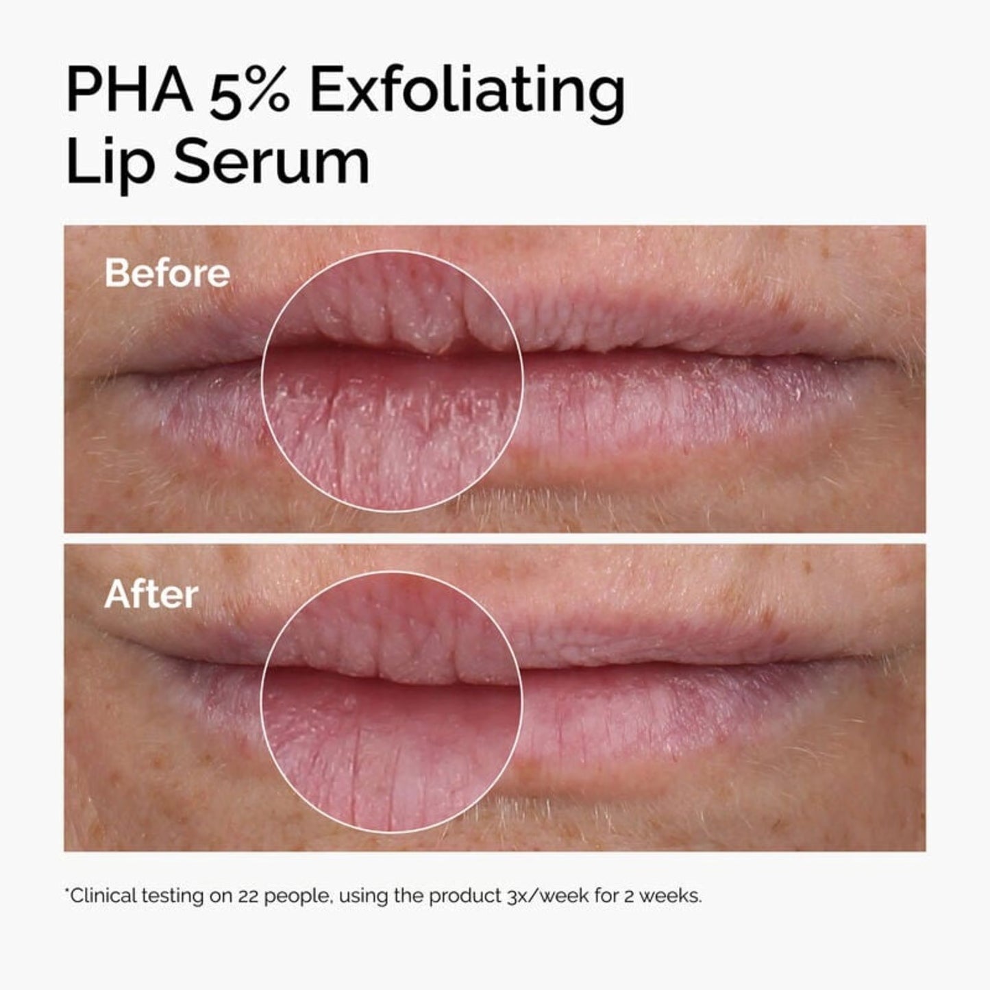 PHA 5% Exfoliating Lip Serum | Suero exfoliante para labios