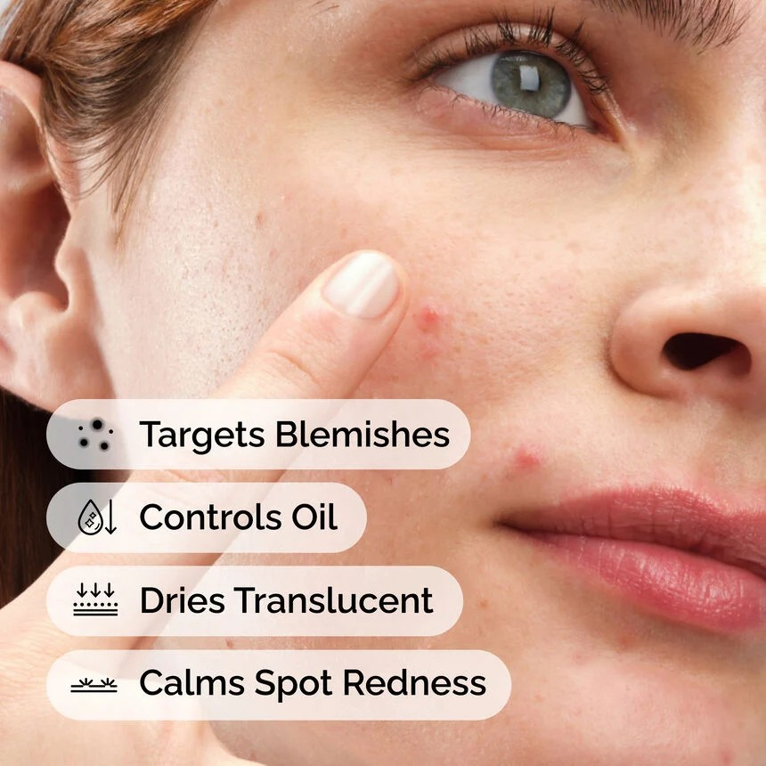 Sulfur 10% Powder-to-Cream Concentrate | Tratamiento para brotes